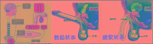 男性假体植入动画图片