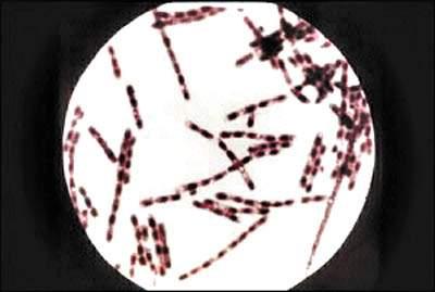 炭疽杆菌分布图片