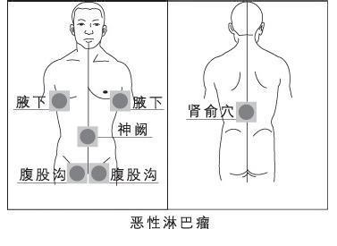 何杰金氏病 搜狗百科