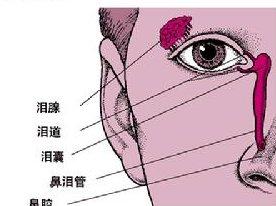 慢性泪囊炎