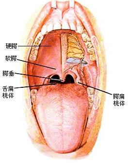 腭垂发炎怎么治图片