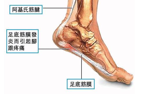 跟骨骨刺 搜狗百科