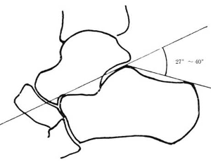 图1——跟骨结节角