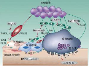 1發病機制多發性骨髓瘤(multiple myeloma)是漿細胞異常增生的腫瘤性