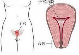 子宫异常出血