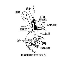 急性胆源性胰腺炎