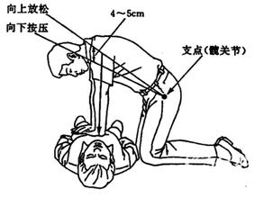 心脑肺复苏