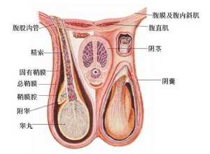 睾丸结石