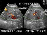 心脏结构检查