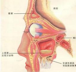 上颌窦的位置图片图片