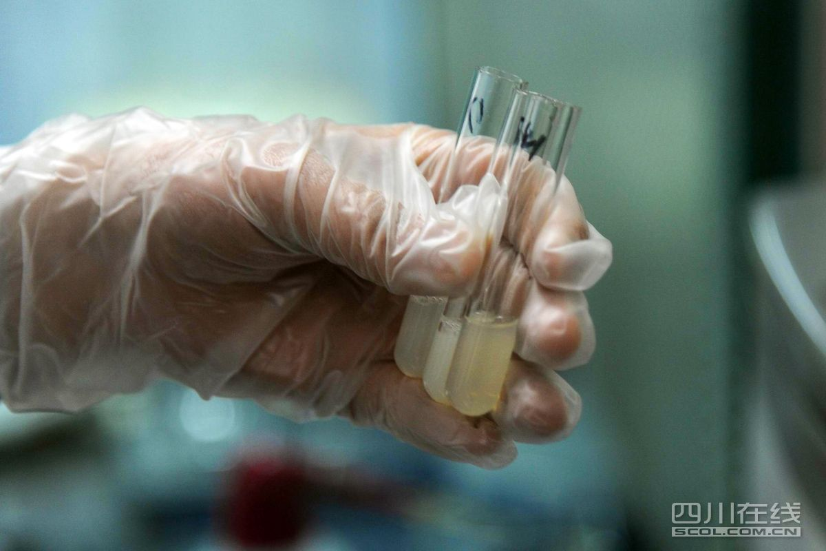 精液为何呈果冻状?它怎么会引起不育呢? - 医药经