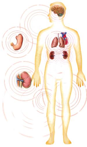 老年多器官功能不全综合征的研究现状