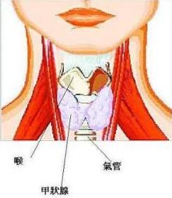 甲状腺结核