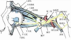 眼外肌发育不全