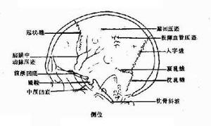 中枢神经系统淋巴瘤