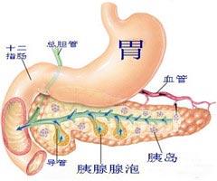 胰腺假囊肿