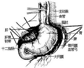 食管癌手术示意图