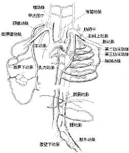腹主动脉缩窄