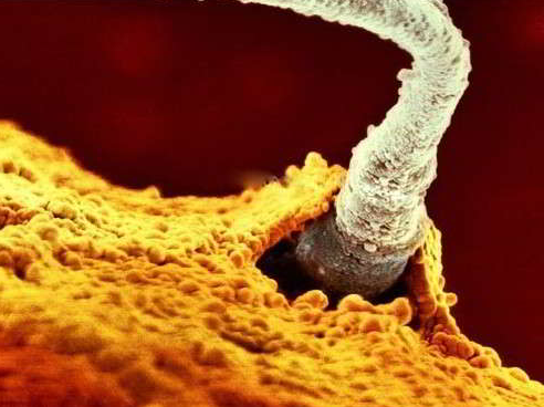卵细胞肉眼图片图片
