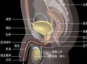 前列腺鈣化