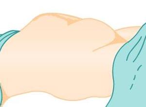 此凹陷会逐渐上升达脐平或脐部以上,称为病理缩复环(pathologicretrac
