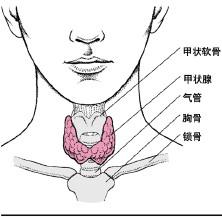 自主性高功能性甲状腺腺瘤