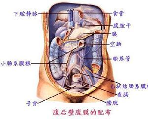 腹膜转移癌