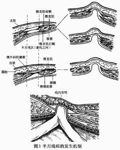 半月线和弓状线图片