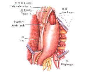 食管平滑肌瘤