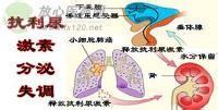 抗利尿激素分泌失调综合征