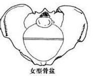 骨盆狭小