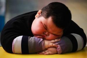 肥胖性心肺功能不全综合征多发于极度肥胖的患者,是肥胖症患者中一种