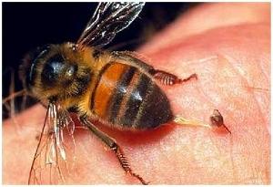 蜂针液分泌物蜂针中文名词条图册快速导航马蜂的蜂针是蜜蜂的自卫器官
