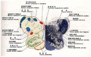 脑橄榄体解剖图片