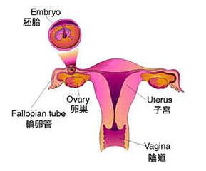 卵巢性不孕