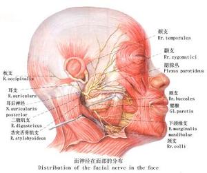 听神经鞘瘤