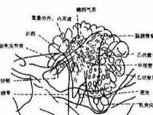 急性乳突炎