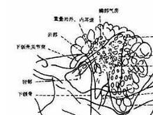 急性化脓性乳突炎