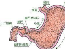 溃疡龛影