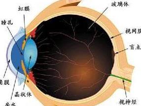 青光眼斑