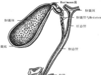 胆管断裂