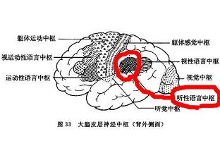 感觉性失语