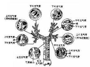 喉气管瘢痕性狭窄
