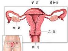子宫
