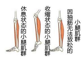 全身骨骼肌痉挛