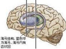 低血糖综合征