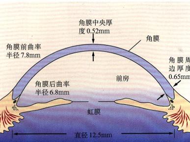 匐行性角膜溃疡