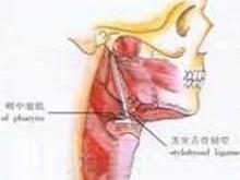 先天性喉蹼