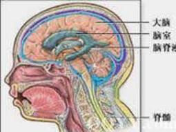 脑疝危象