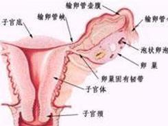 盆腔腹膜炎